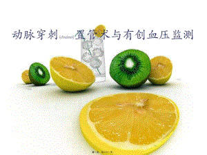 2022年醫(yī)學(xué)專題—?jiǎng)用}穿刺置管術(shù)與有創(chuàng)血壓監(jiān)測(cè)-展示頁(yè)
