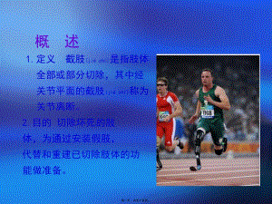 2022年醫(yī)學(xué)專題—截肢康復(fù)評(píng)定-閱讀頁