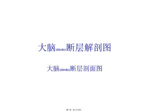 2022年醫(yī)學(xué)專題—大腦結(jié)構(gòu)圖圖例-在線瀏覽