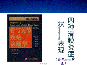 2022年醫(yī)學專題—滑膜炎癥狀匯編-免費閱讀