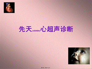 2022年醫(yī)學(xué)專題—胎兒超聲心動(dòng)圖ppt-wenkub.com