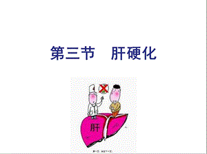 2022年醫(yī)學(xué)專題—第四節(jié)--肝硬化-閱讀頁