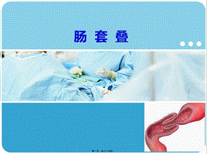 2022年醫(yī)學(xué)專(zhuān)題—腸套疊-預(yù)覽頁(yè)