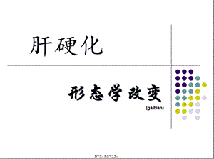 2022年醫(yī)學(xué)專題—肝硬化12(文件)