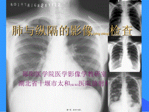 2022年醫(yī)學(xué)專題—肺與縱隔-檢查與正常-wenkub.com
