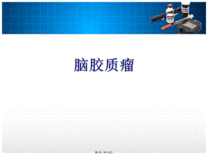 2022年醫(yī)學(xué)專題—腦膠質(zhì)瘤講課-wenkub