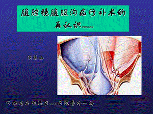 2022年醫(yī)學(xué)專題—腹腔鏡腹股溝疝修補(bǔ)術(shù)的再認(rèn)識(留存版)