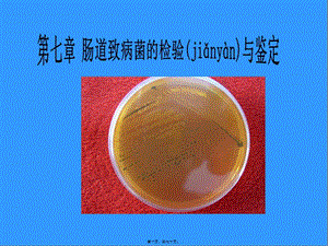 2022年醫(yī)學(xué)專(zhuān)題—腸道致病菌檢驗(yàn)簡(jiǎn)述-預(yù)覽頁(yè)