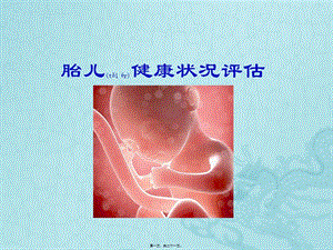 2022年醫(yī)學(xué)專題—胎兒健康狀況評估-全文預(yù)覽