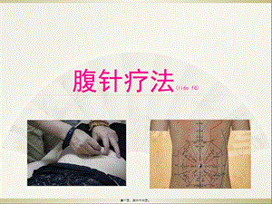 2022年醫(yī)學(xué)專題—腹針療法幻燈-閱讀頁