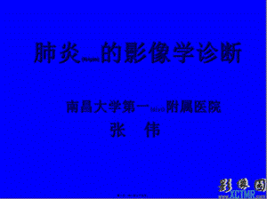 2022年醫(yī)學(xué)專題—肺炎型顯示肺野小片或大片陰影-影像ftp-全文預(yù)覽
