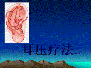 2022年醫(yī)學(xué)專題—耳壓療法(編輯修改稿)
