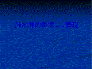 2022年醫(yī)學(xué)專題—肺水腫-文庫(kù)吧資料