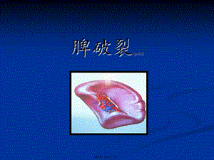 2022年醫(yī)學(xué)專題—脾破裂-修-wenkub