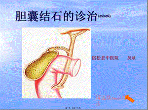 2022年醫(yī)學(xué)專題—膽結(jié)石ppt(文件)