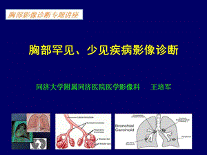 胸部少見、罕見疾病影像診斷(參考版)