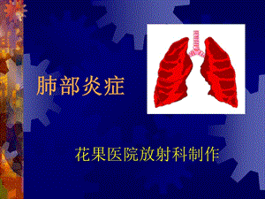 肺部炎癥影像學(xué)診斷(存儲版)