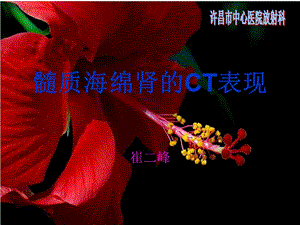《髓質(zhì)海綿腎》ppt課件-展示頁
