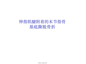 伸指肌腱附著的末節(jié)指骨基底撕脫骨折3種內(nèi)固定方式(參考版)