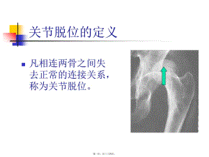 5關(guān)節(jié)脫位的急救(編輯修改稿)